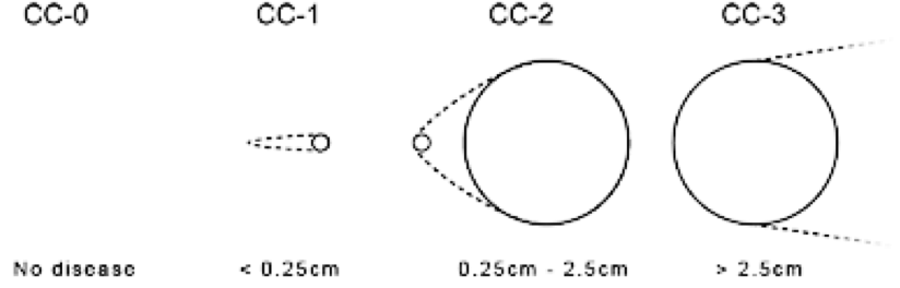 15.13.2. ANNEXE 2 - CC-score (completeness of cytoreduction score)