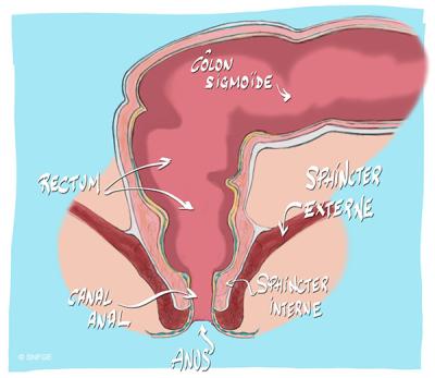 anus-rectum_illustration_o_juanati_-_c_snfge_bd.jpg