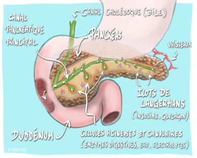 cancer_du_pancreas_illustration_olivier_juanati_-_c_snfge_bd.jpg