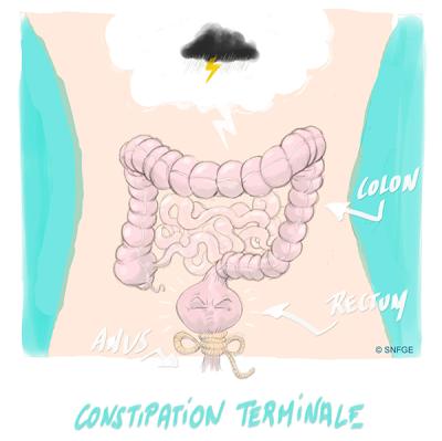 constipation_terminale_illustration_olivier_juanati_-_c_snfge.jpg