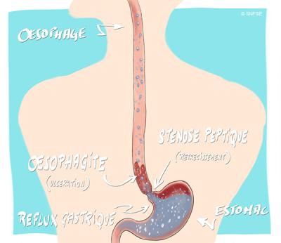 rgo_illustration_o_juanati_-_c_snfge_bd.jpg