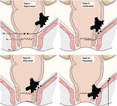 tncd_chap-05_classification-rullier.jpg