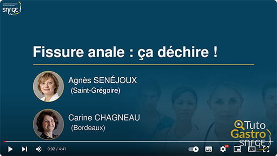 TutoGastro-SNFGE_Fissure anale_2024 (copyright SNFGE).png