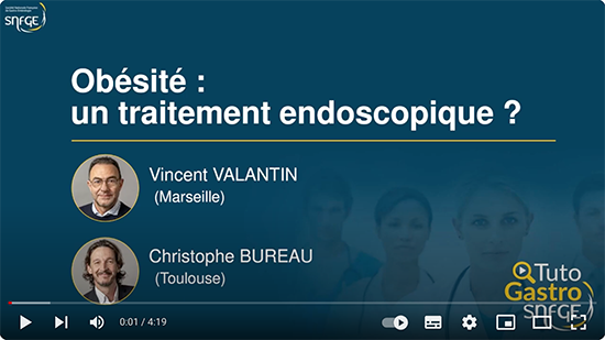 TutoGastro-SNFGE_Obésité_un traitement endoscopique_2024 (copyright SNFGE).png