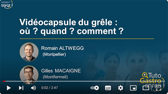 TutoGastro-SNFGE_Vidéocapsule du grêle_2024 (copyright SNFGE).png