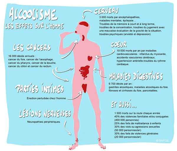 alcoolisme-homme_illustration_o_juanati_-_c_snfge_bd.jpg