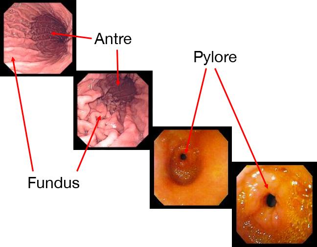 anatomie_estomac.jpg