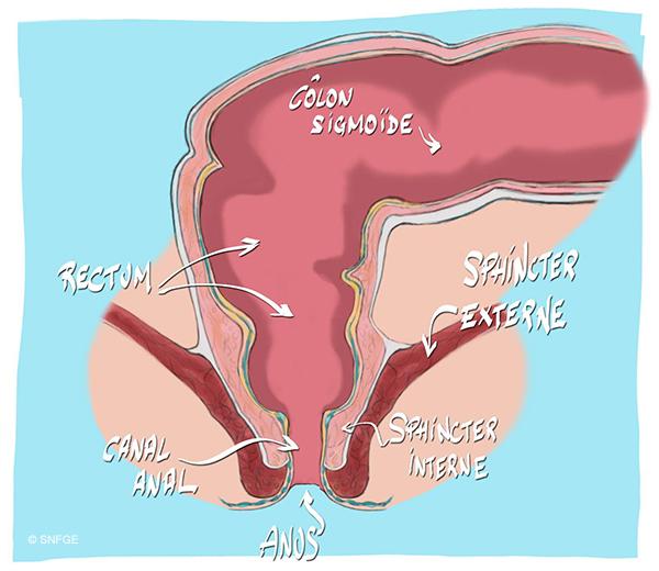 anus-rectum_illustration_o_juanati_-_c_snfge_bd.jpg