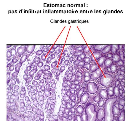 coupe_histologique_estomac-gastrite-1_droits_g_belleannee_a_de_mascarel.jpg