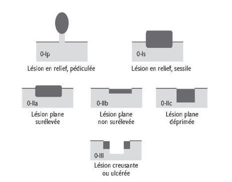tncd_chap-01_figure-2.png