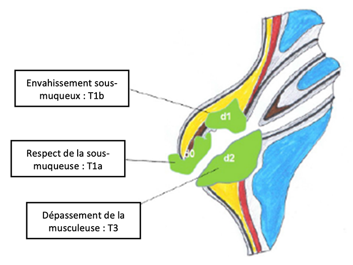 tncd_chap-19_figure1.png